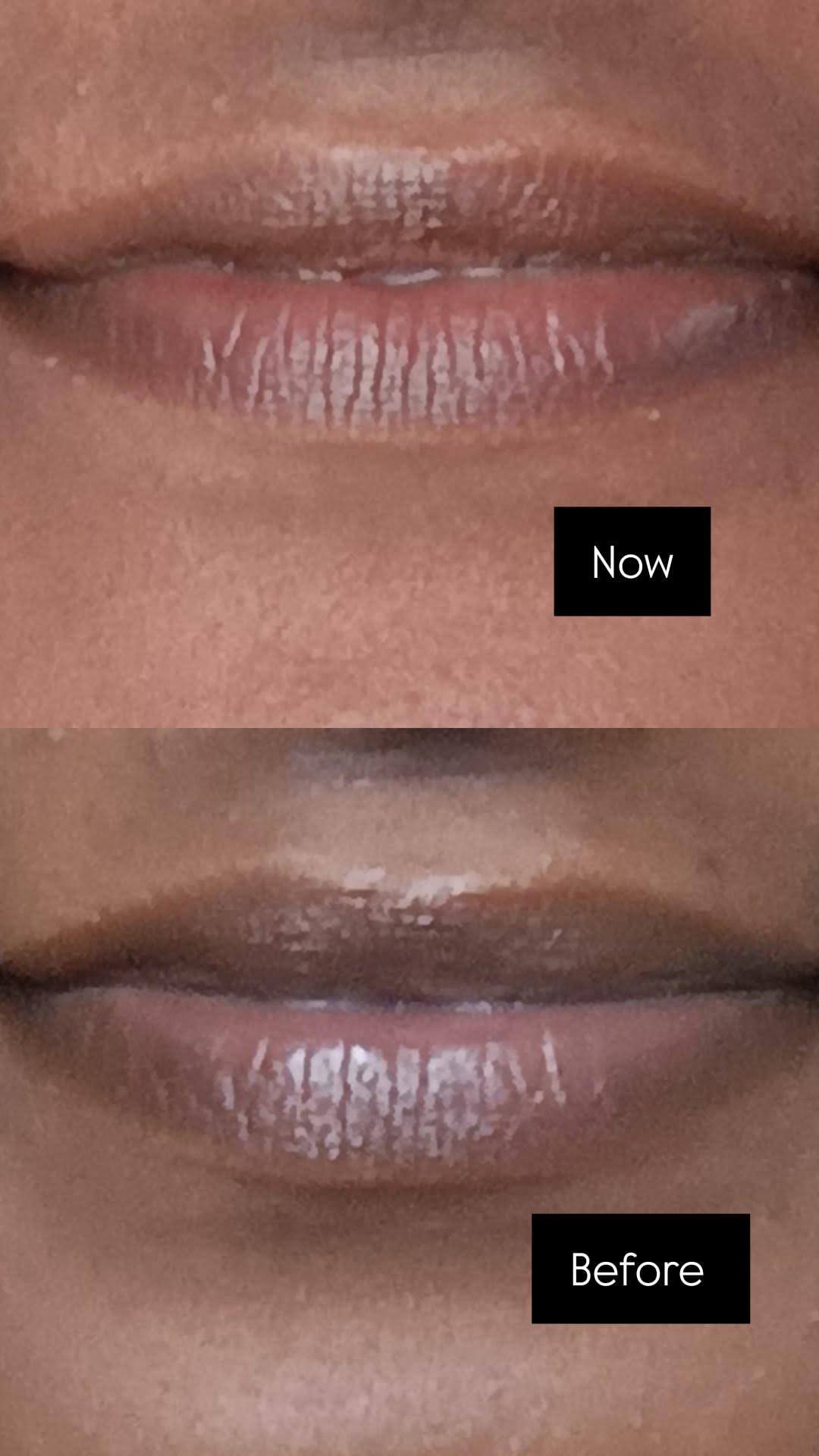Restored Hydration & Even Pigment Tone